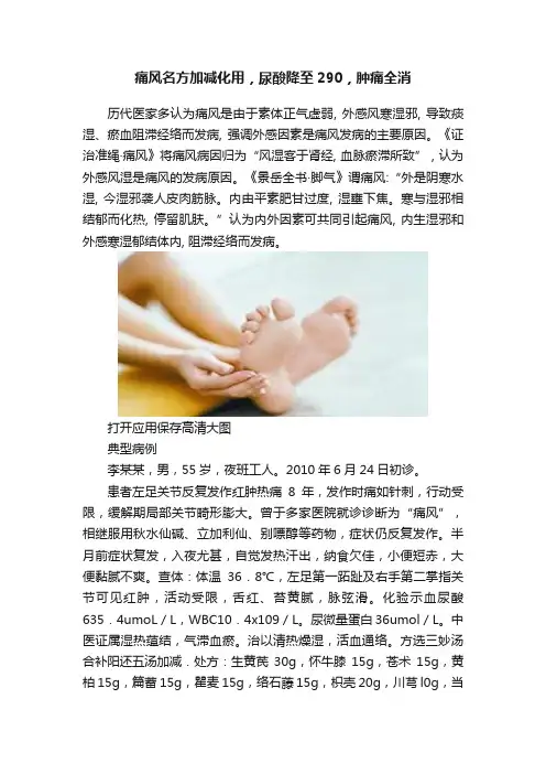 痛风名方加减化用，尿酸降至290，肿痛全消