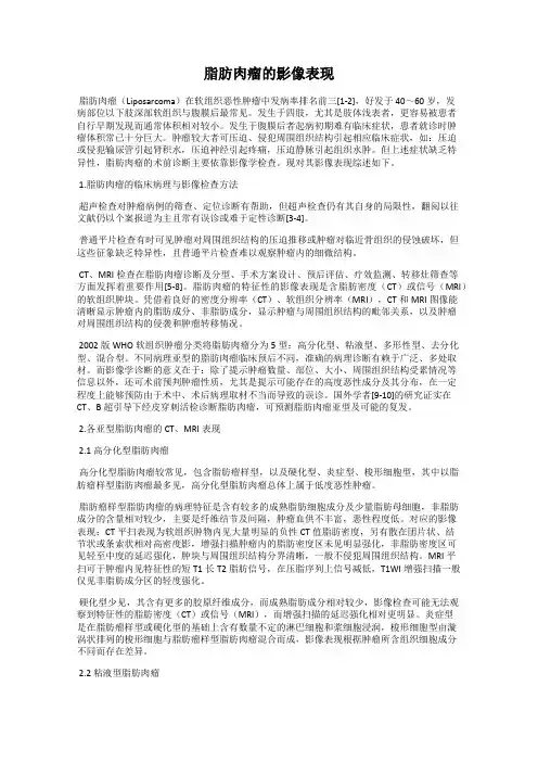 脂肪肉瘤的影像表现