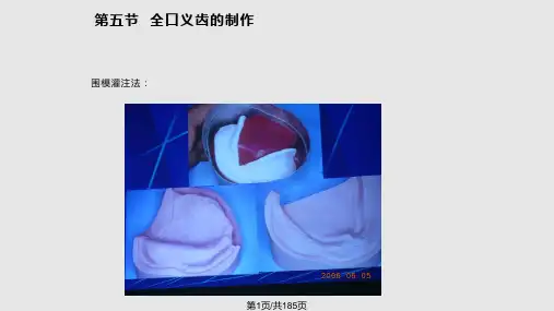 全口义齿专科讲课PPT课件