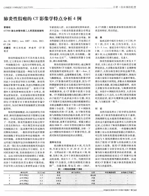 肺炎性假瘤的CT影像学特点分析4例