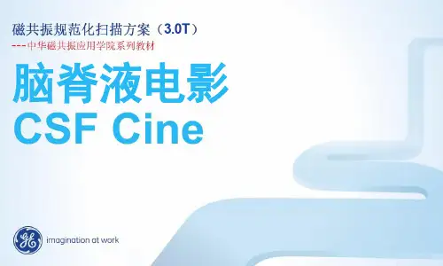 脑脊液电影CSF规范化扫描方案