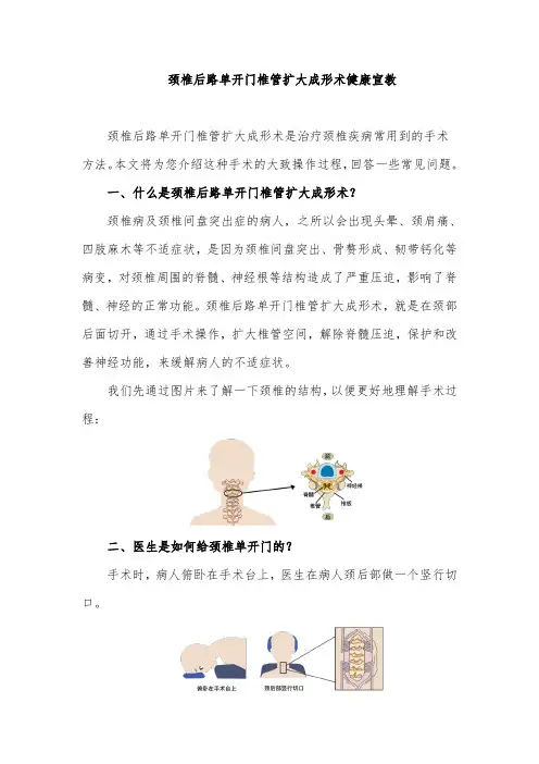颈椎后路单开门椎管扩大成形术健康宣教