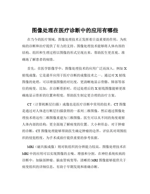 图像处理在医疗诊断中的应用有哪些