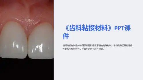 《齿科粘接材料》课件