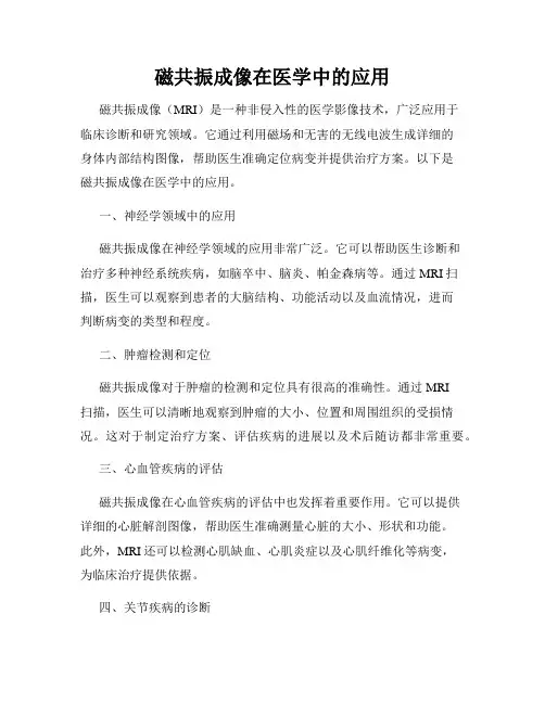 磁共振成像在医学中的应用