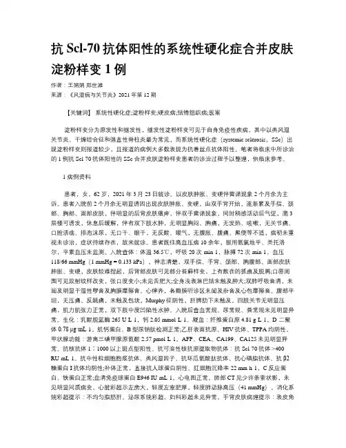 抗Scl-70抗体阳性的系统性硬化症合并皮肤淀粉样变1例