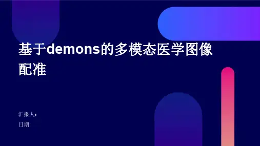 基于demons的多模态医学图像配准