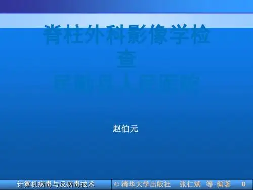 脊柱外科影像学检查ppt课件