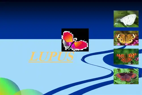 系统性红斑狼疮 SLE(共40张PPT)