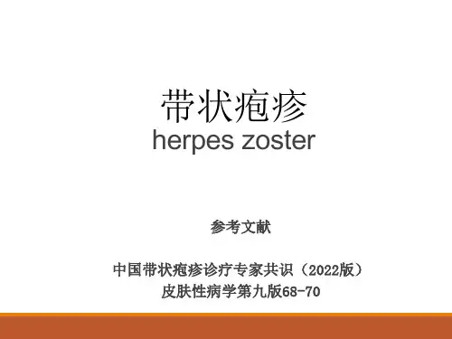 带状疱疹的诊治