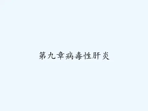 第九章病毒性肝炎 PPT