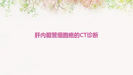 肝内胆管细胞癌的CT诊断