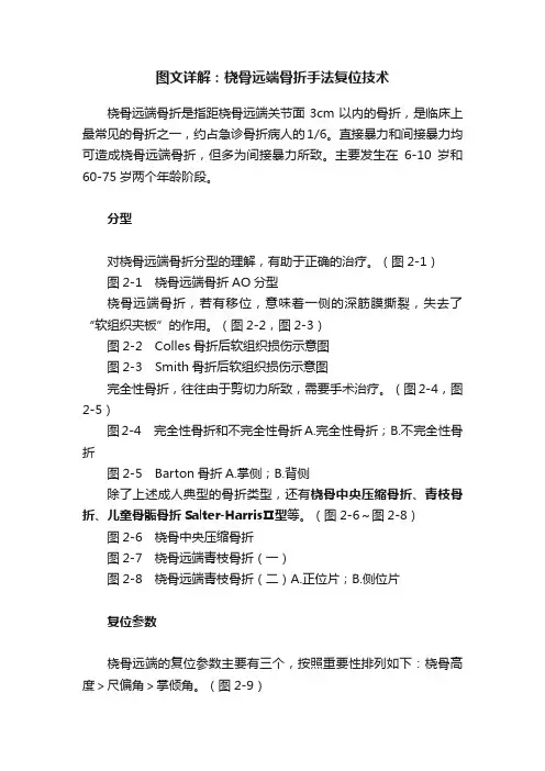 图文详解：桡骨远端骨折手法复位技术