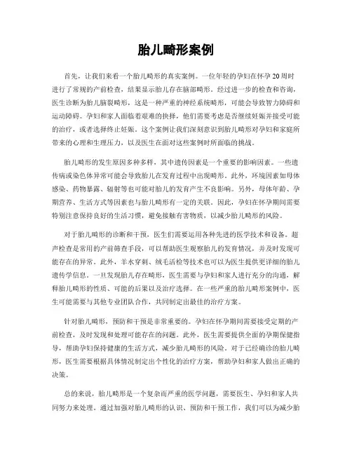 胎儿畸形案例