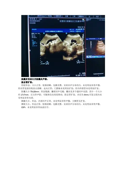 肝胆胰脾超声图文报告