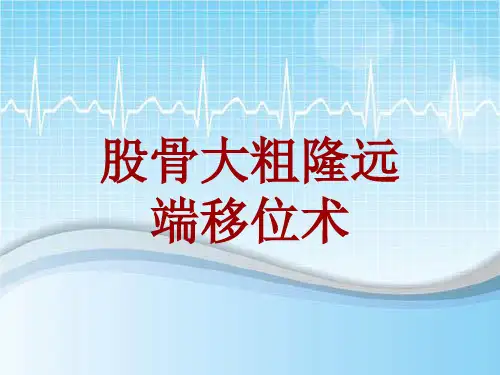 手术讲解模板：股骨大粗隆远端移位术