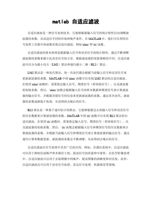 matlab 自适应滤波