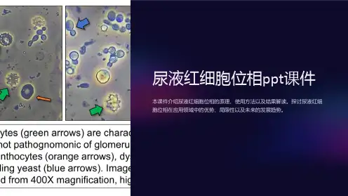 尿液红细胞位相课件