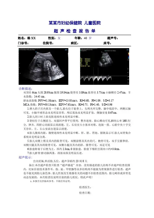 超声检查报告单模板