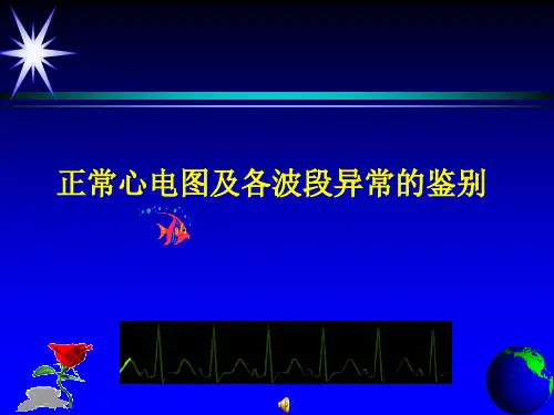 正常心电图及各波段异常的鉴别..