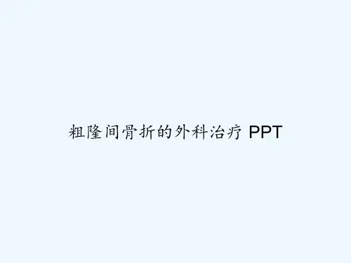 粗隆间骨折的外科治疗 PPT