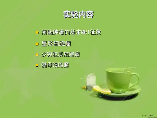 颅脑肿瘤MRI