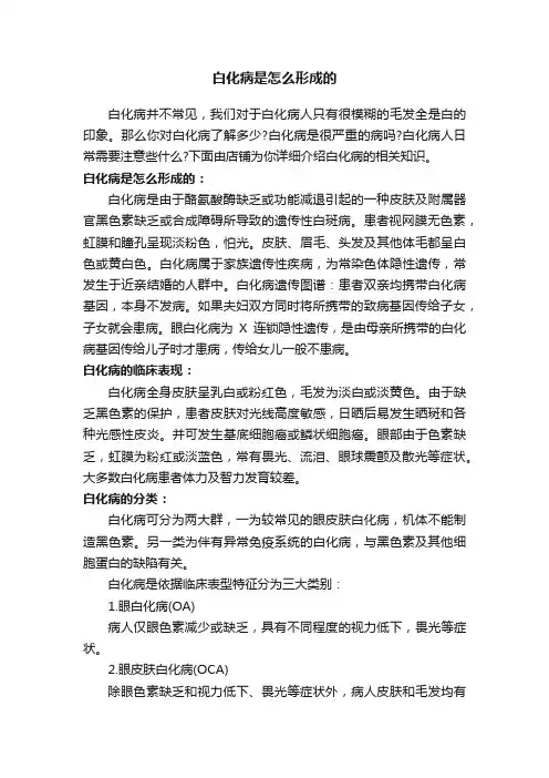 白化病是怎么形成的