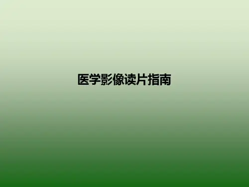 医学影像读片指南-PPT课件
