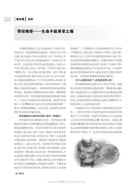 带状疱疹——生命不能承受之痛