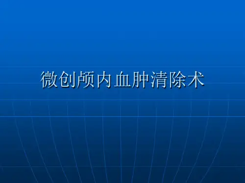 血肿穿刺术