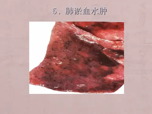 病理学图谱 实验二局部血液循环障碍