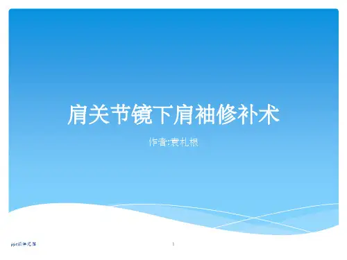 肩关节镜下肩袖修补