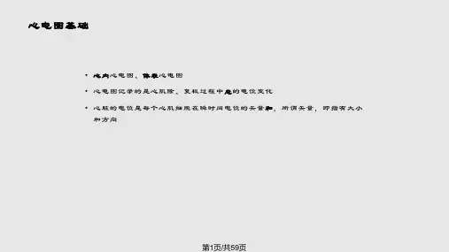 完全性LBBB左束支传导阻滞PPT课件