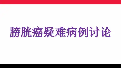 膀胱癌疑难病例讨论ppt模板