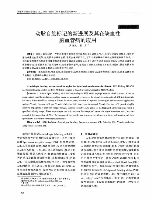 动脉自旋标记的新进展及其在缺血性脑血管病的应用