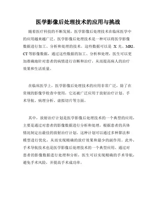 医学影像后处理技术的应用与挑战