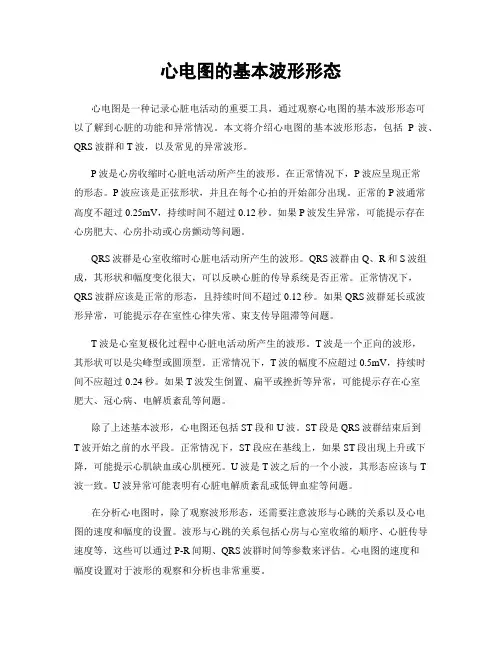 心电图的基本波形形态