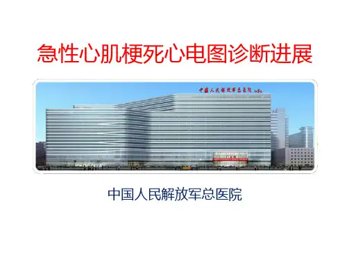 【心电图 课件】急性心肌梗死诊断最标准