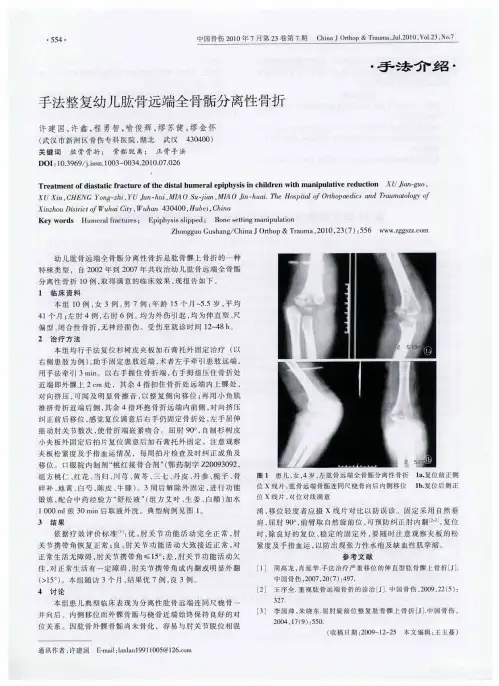 手法整复幼儿肱骨远端全骨骺分离性骨折