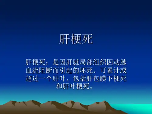 肝脏梗死