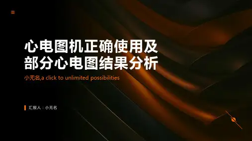 心电图机正确使用及部分心电图结果分析