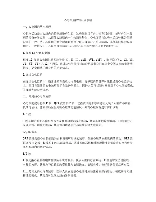 心电图监护知识点总结