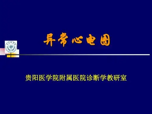 异常心电图检查全部