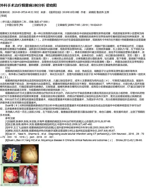 外科手术治疗烟雾病1例分析     梁晓阳