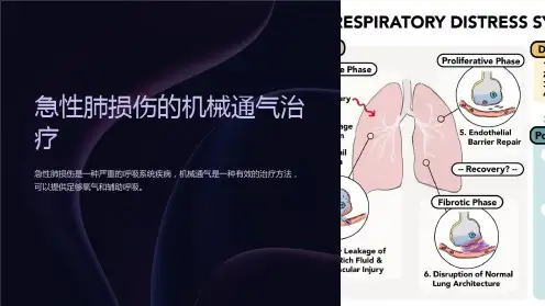 急性肺损伤的机械通气治疗
