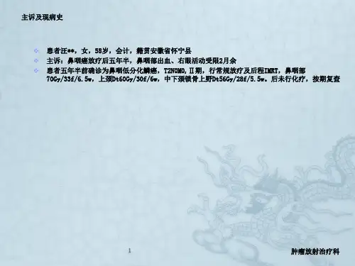 鼻咽癌放疗后复发IMRT靶区勾画修改终稿  李广虎