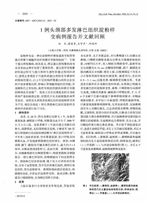1例头颈部多发淋巴组织淀粉样变病例报告并文献回顾