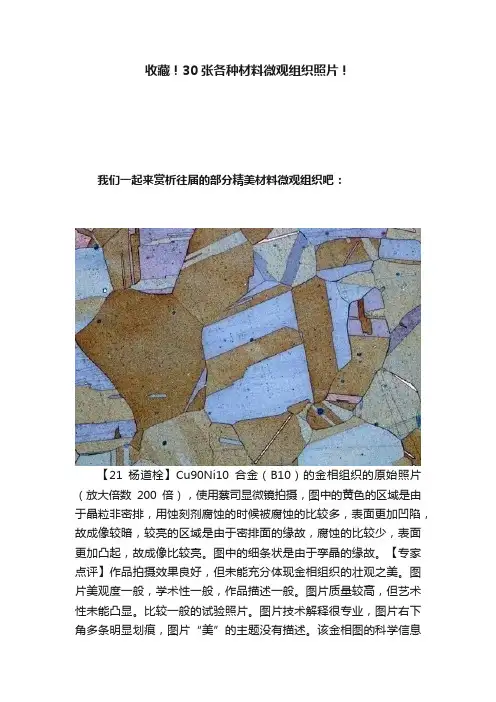 收藏！30张各种材料微观组织照片！
