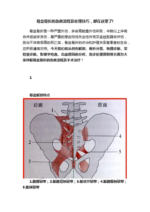 骨盆骨折的急救流程及处理技巧，都在这里了!