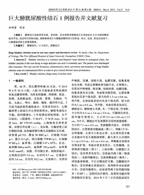 巨大膀胱尿酸性结石1例报告并文献复习